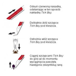 BEAPHAR Tick Boy - Szczypce do usuwania kleszczy